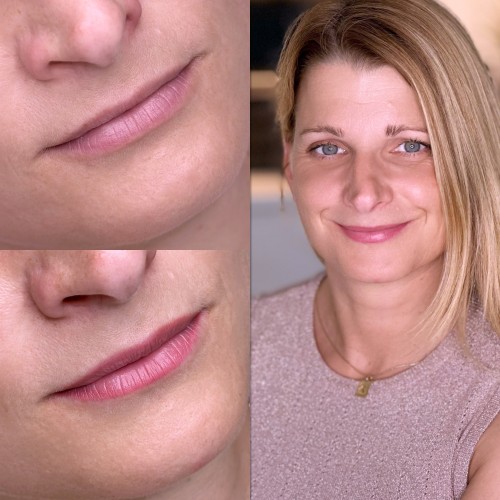 Gyógyult ajaktetoválások Gyógyult ajaktetoválások