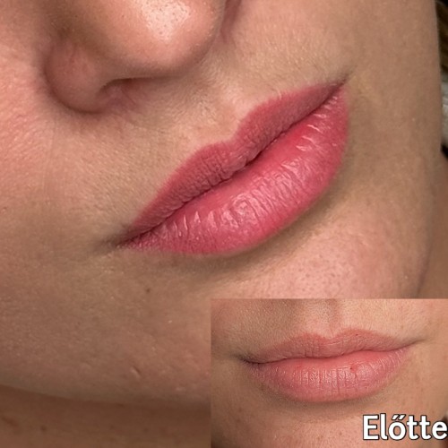 Gyógyult ajaktetoválások Gyógyult ajaktetoválások