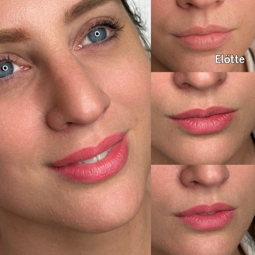 Gyógyult ajaktetoválások Gyógyult ajaktetoválások