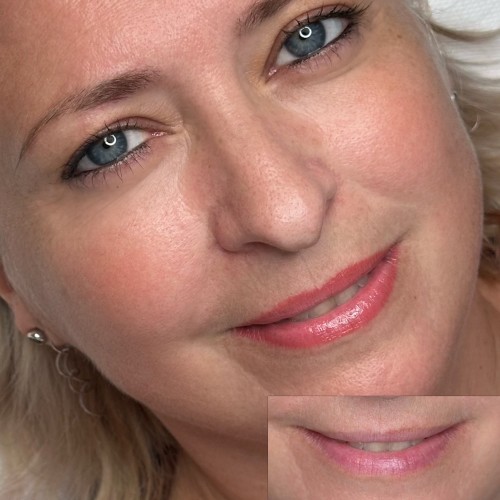 Gyógyult ajaktetoválások Gyógyult ajaktetoválások