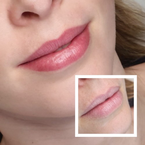 Gyógyult ajaktetoválások Gyógyult ajaktetoválás képek