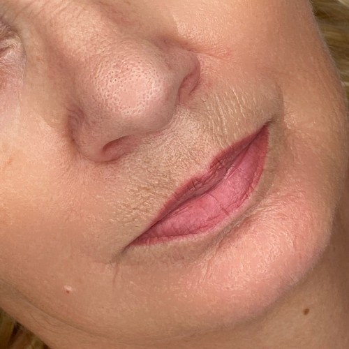 Gyógyult ajaktetoválások Gyógyult ajaktetoválások