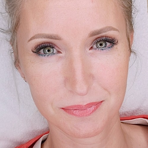 Gyógyult ajaktetoválások Gyógyult ajaktetoválások