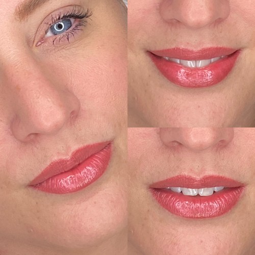 Gyógyult ajaktetoválások Gyógyult ajaktetoválások