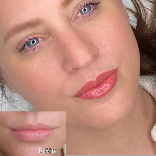 Gyógyult ajaktetoválások Gyógyult ajaktetoválások